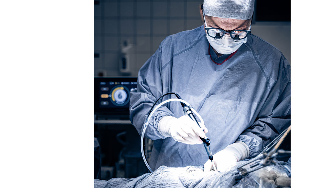 Bildsequenz HEPACCS Cutting-edge dissection experience